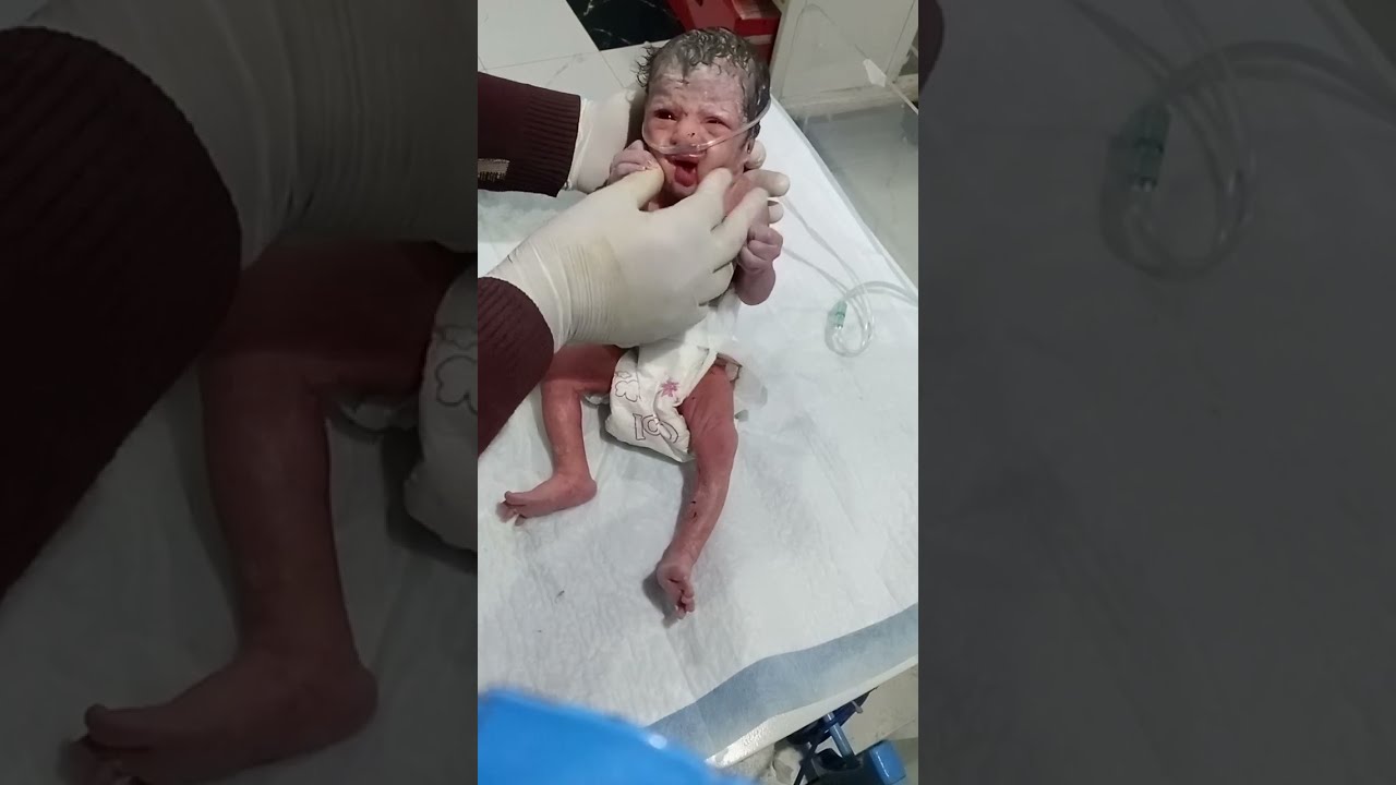 Newborn Baby Critical Condition Assessment | Step-by-Step Emergency Neonatal Examination greauting 