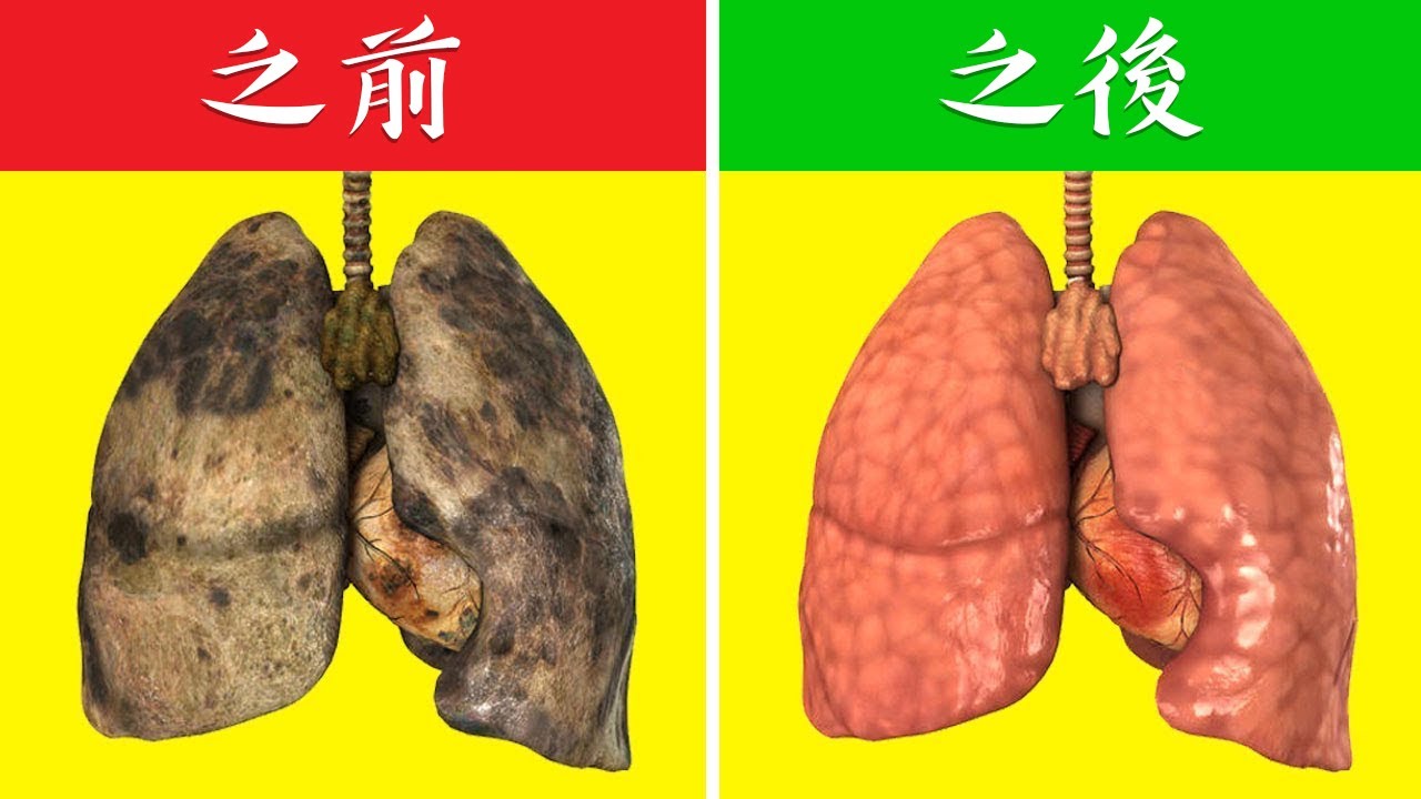 空氣污染毀肺?柏格醫生教你排毒