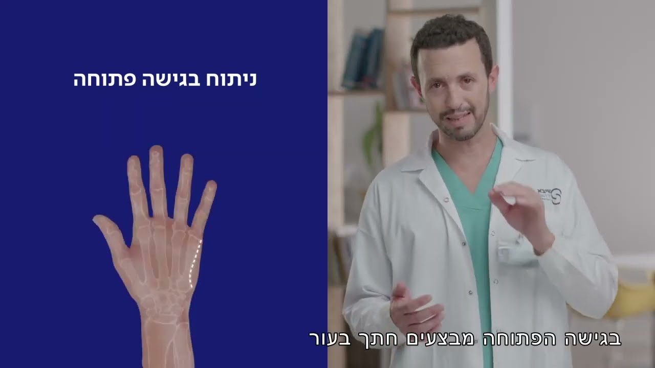 שברים בעצמות האצבעות | שיבא - המערך הכירורגי
