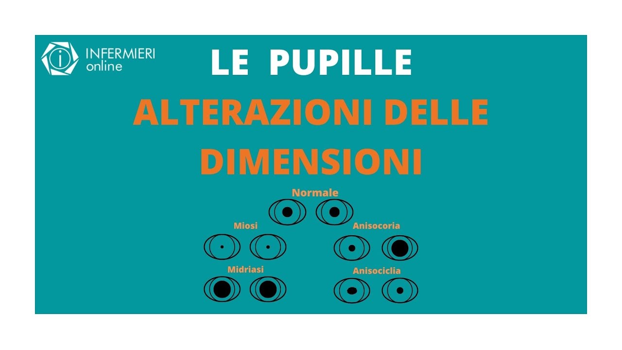 LE PUPILLE | ALTERAZIONI DELLE DIMENSIONI | INFERMIERI online