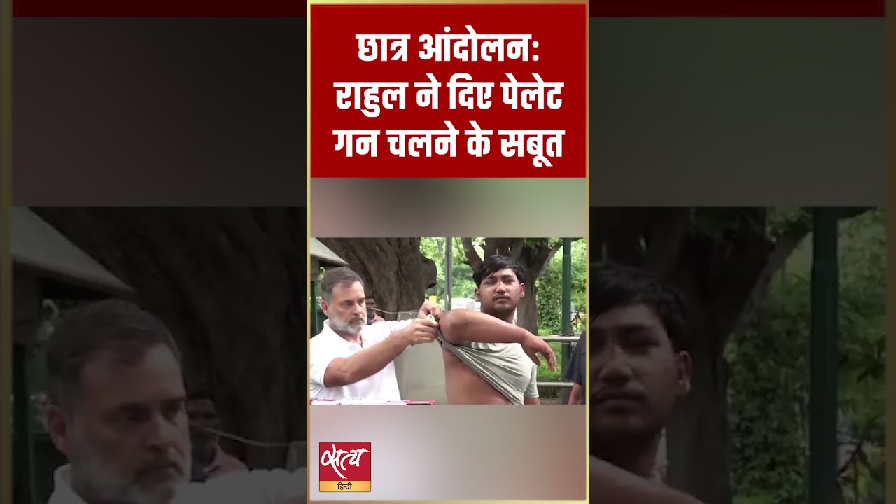 Student Protest: Pellet Gun का शिकार युवक! Rahul Gandhi ने पेश किया खौफनाक सबूत #Shorts