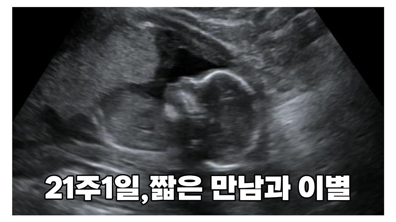그동안 영상을 올리지 못했던 이유, 21주1일 한방이를 떠나보내며..