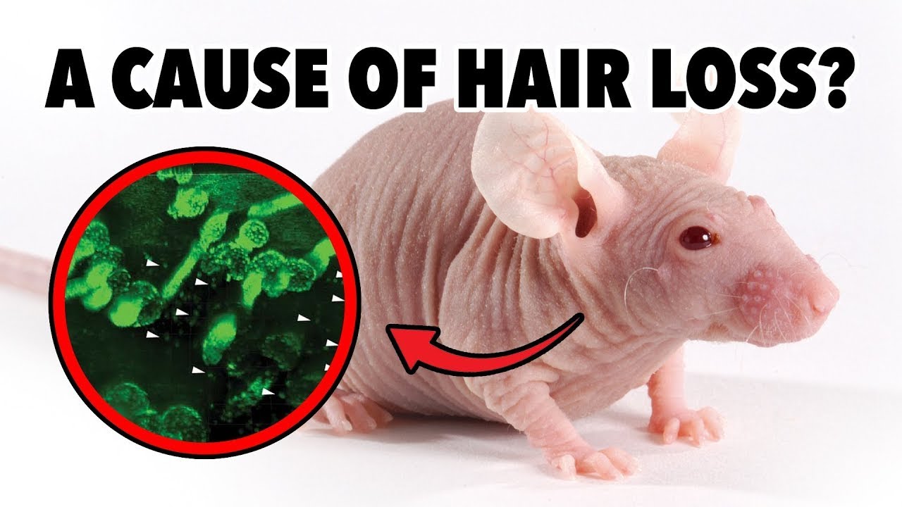 Hair Loss Cure? Stem Cell Escape Identified!