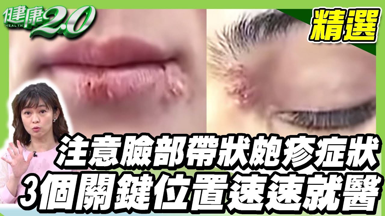 注意臉部帶狀皰疹症狀！ 臉上長皮蛇要注意 長在這3個關鍵位置速速就醫【健康2.0精選】
