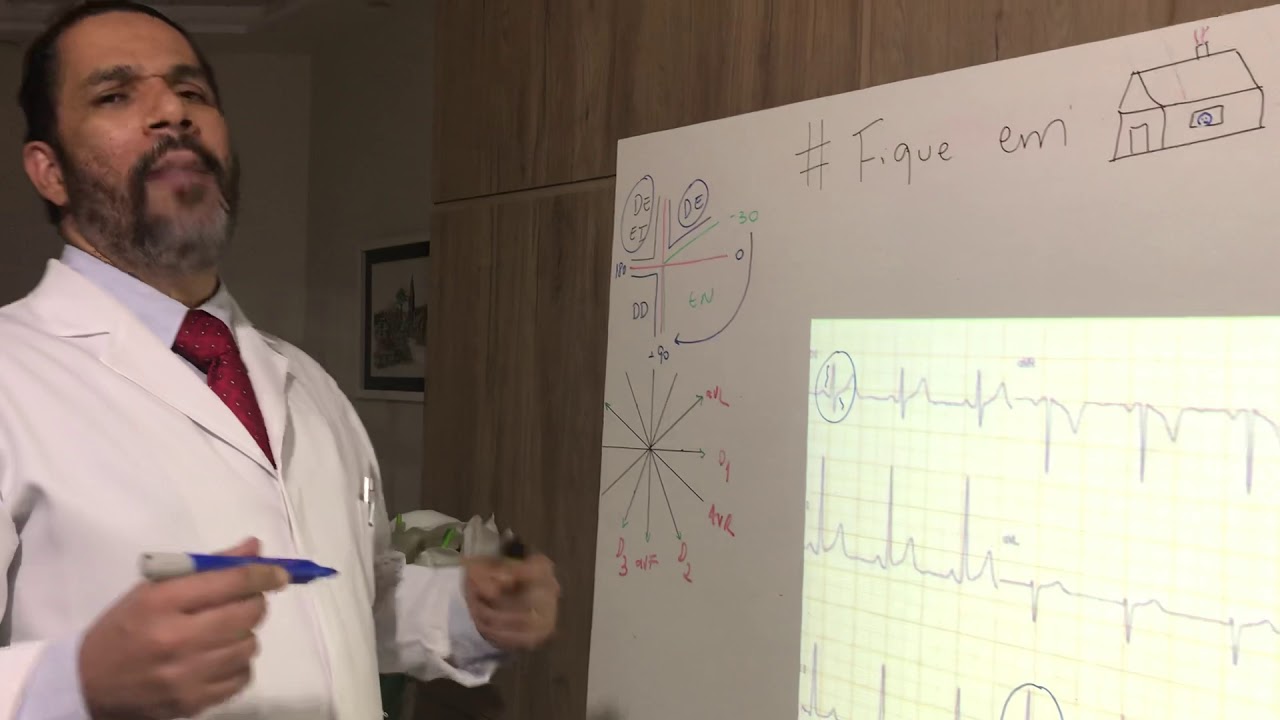 Aula 15: Exerc&iacute;cios de Determina&ccedil;&atilde;o do Eixo do Vetor M&eacute;dio de Despolariza&ccedil;&atilde;o do QRS