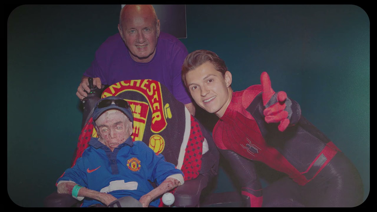 Tom Holland and The Brothers Trust's Hope to Heal EB | Venture Into Cures 2021