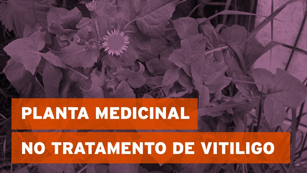 Planta medicinal no tratamento de vitiligo