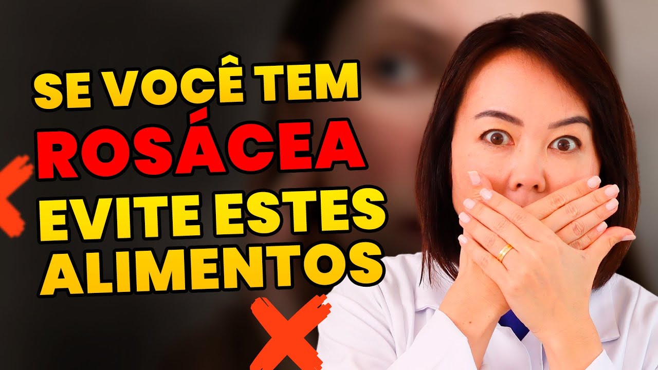 Evitar esses alimentos se voce tem rosacea e importante!