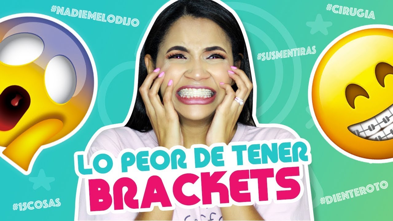 LO PEOR DE TENER BRACKETS / Mi Cirugía