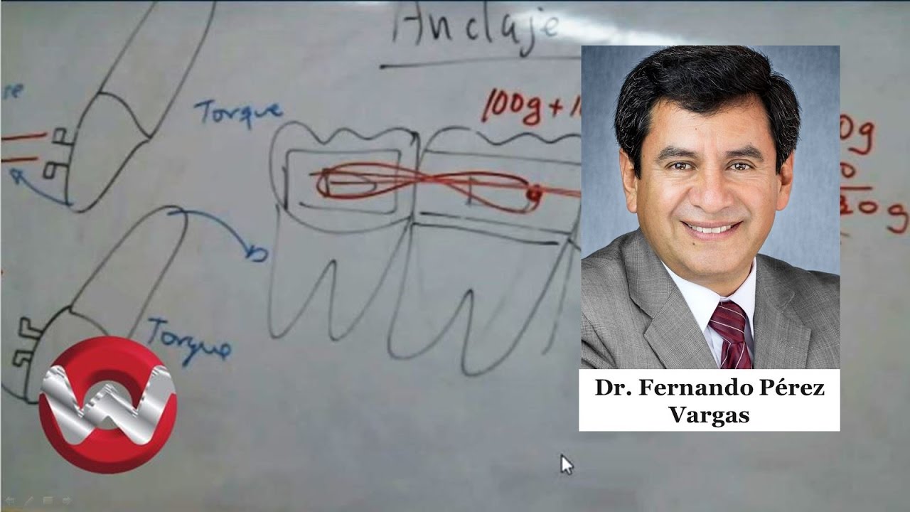 ¿Que es anclaje en ortodoncia?