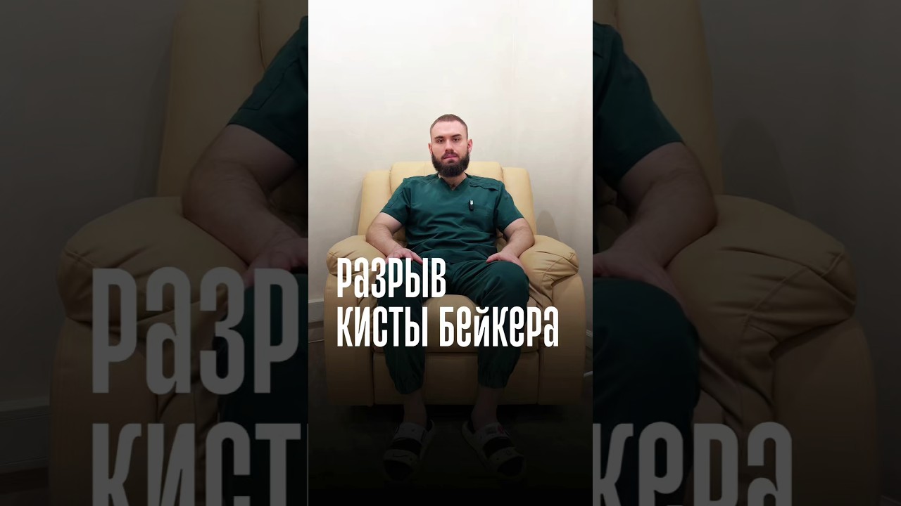 Разрыв кисты Бейкера - когда икра опухает как шарик!👇!#кистабейкера #разрывкисты #ортопед