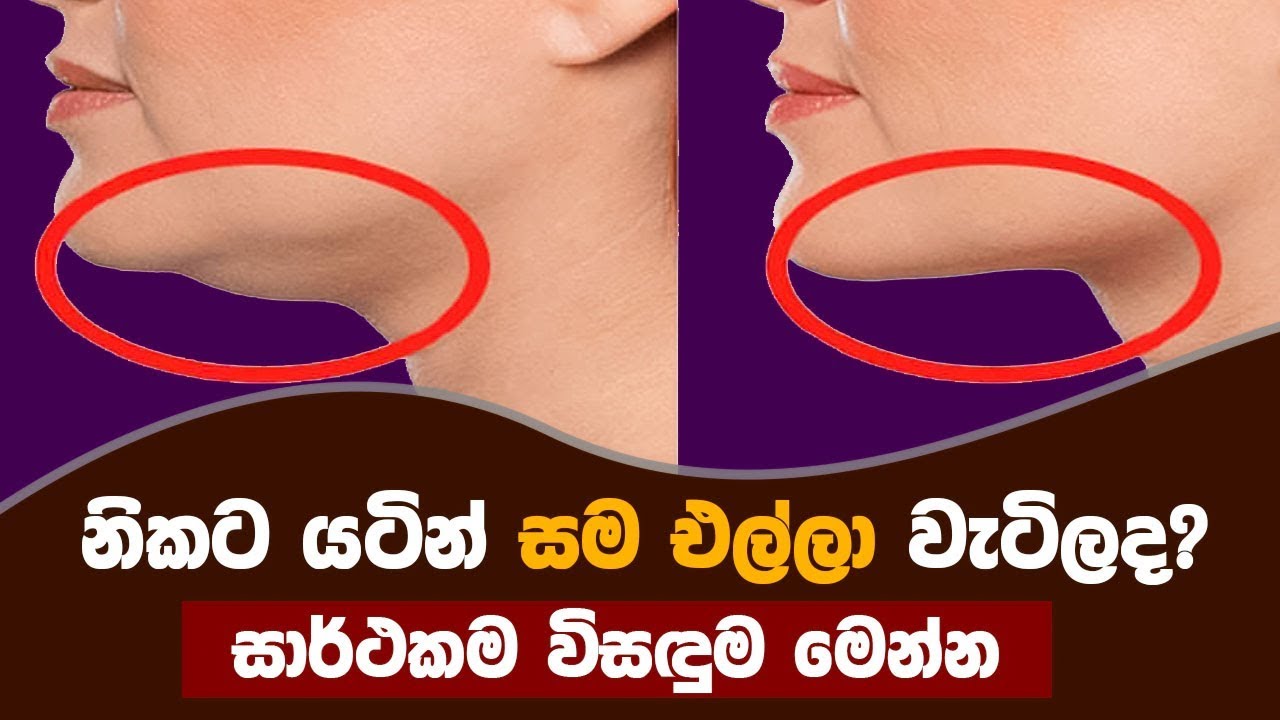 නිකට යටින් සම එල්ලා වැටිලද? සාර්ථකම විසඳුම මෙන්න.