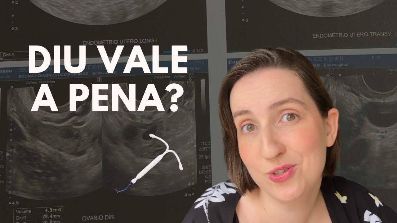 minha experiência com o diu kyleena