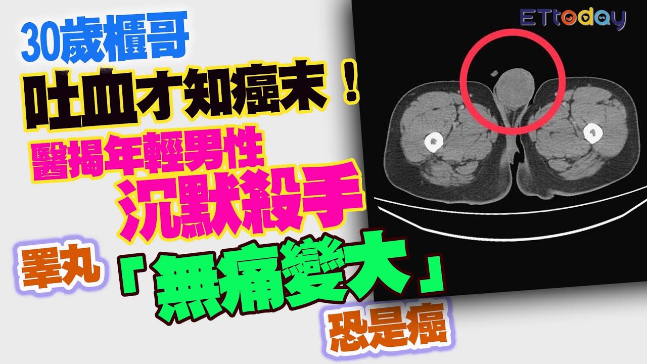 30歲櫃哥吐血才知癌末！　醫揭年輕男性沉默殺手　睪丸「無痛變大」恐是癌