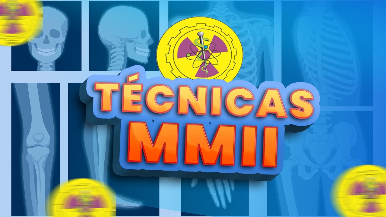 TODAS INCIDÊNCIAS MMII | Radiologando
