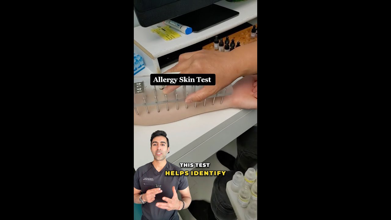 The Simple Skin Test That Reveals Your Allergies