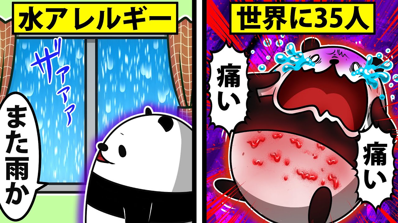 【アニメ】水アレルギーになるとどうなるのか？