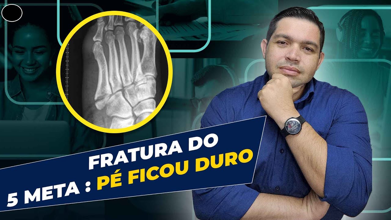 Recuperação de Fraturas do 5 Metatarso - Fisioterapia #05