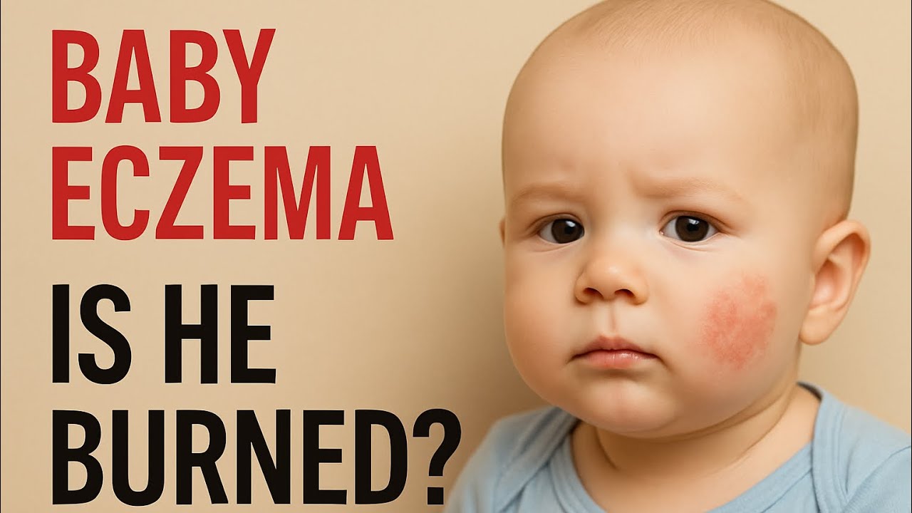‘Is He Burned?’ – Our 3rd A&E Visit for baby eczema 