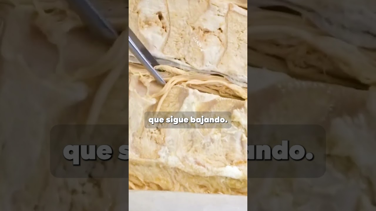 D&oacute;nde termina la m&eacute;dula? #medula #columna #vertebral #anatomia #ciencia #aprender #increible