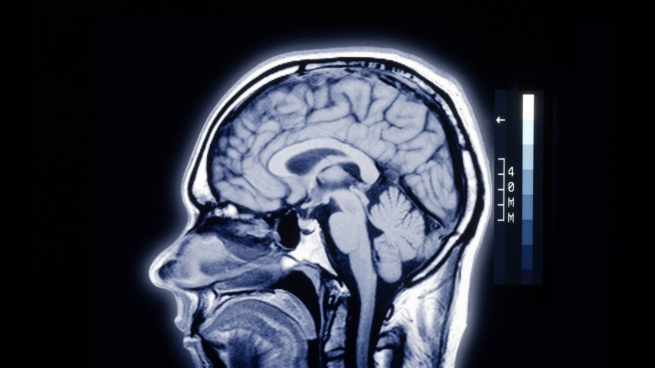 Cleveland Clinic Launches First-of-its-Kind Brain Study