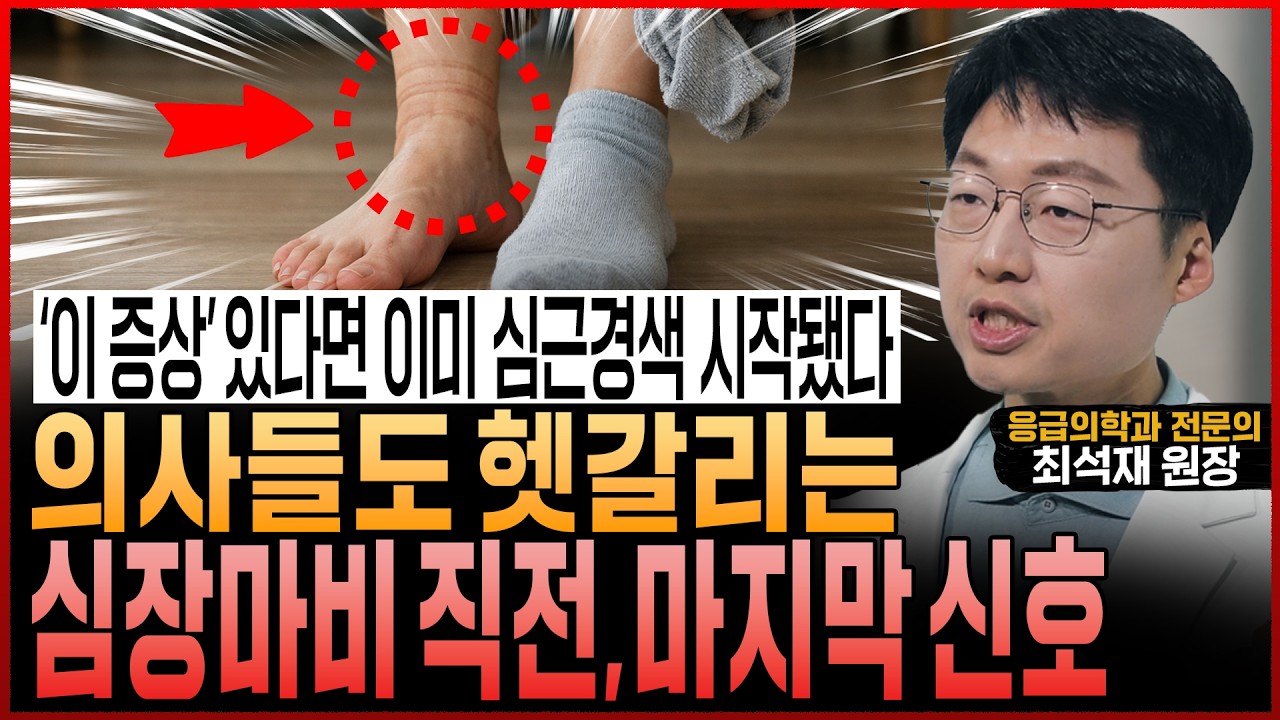 “의사들도 헷갈려서 놓칩니다!” ‘이 증상’ 있다면 심장마비는 이미 시작됐다! 심근경색 최후의 신호 6가지 (최석재 원장)