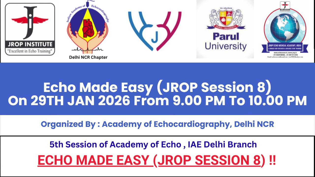 Echo Made Easy - JROP Session 8 !!