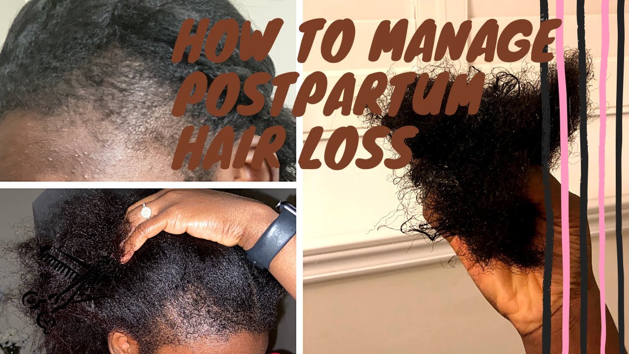 7 Tips for Postpartum Hair loss | How to Manage Excessive Shedding