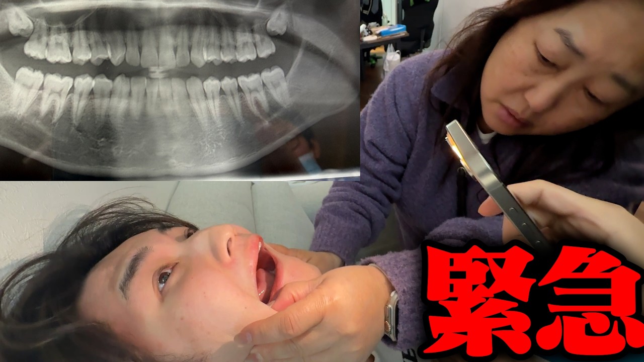 弟の口の中が異変...入院レベルになりました。