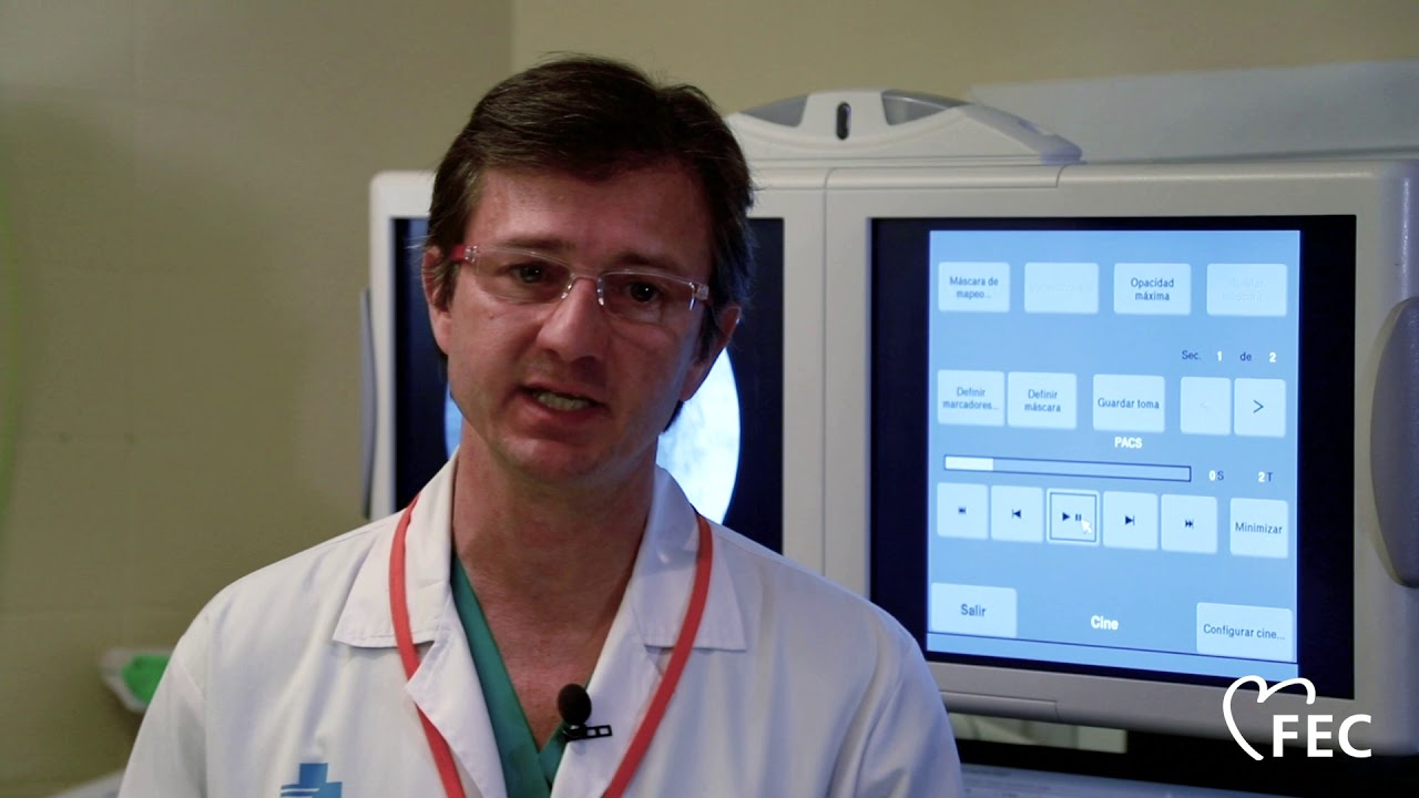 HOLTER ECG