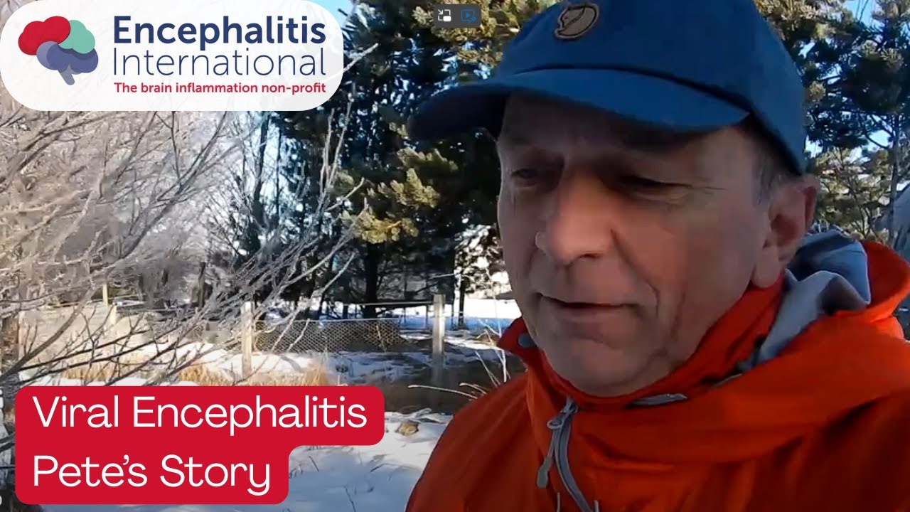 Viral Encephalitis Lived Experience - Pete's Story