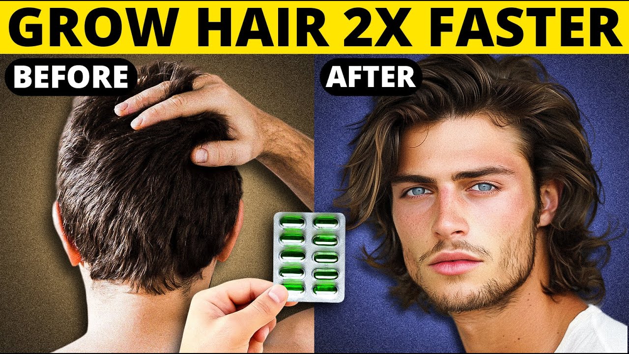 Grow Hair 2x Faster | Hair Growth Tips For Men | हिंदी में