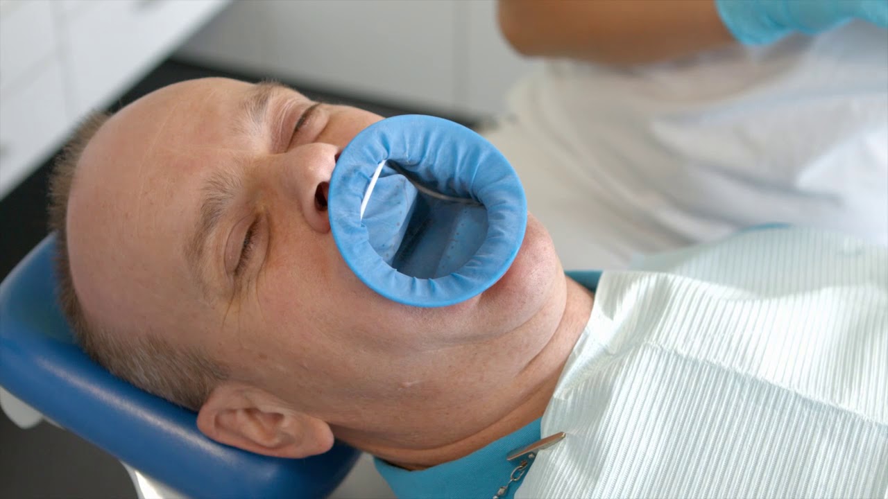 Ivoclar Vivadent - The efficient posterior filling procedure