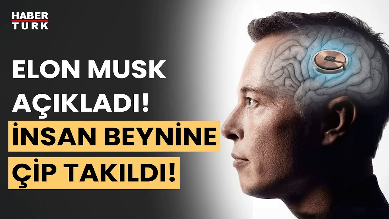 Elon Musk ilk kez bir insanın beynine çip yerleştirdiğini duyurdu!
