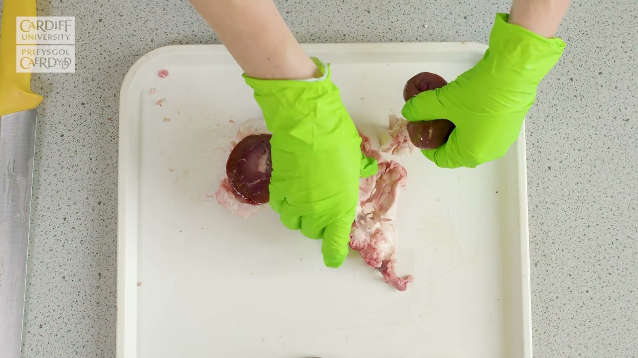 Kidney Dissection Video - Kidneys - WJEC GCSE Biology -  ENGLISH - Unit 2.6