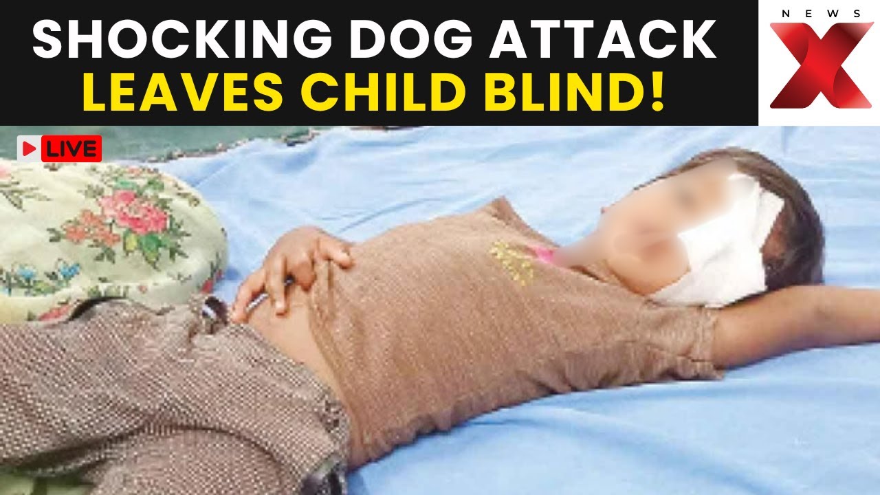Stray Dog Attacks Kid LIVE | Child Loses Eye After Stray Dog Attack In Telangana