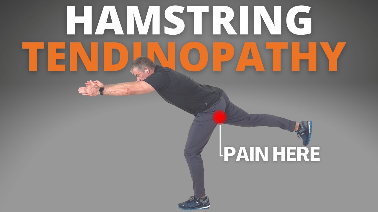 Proximal Hamstring Tendinopathy (REHAB PROGRAM)