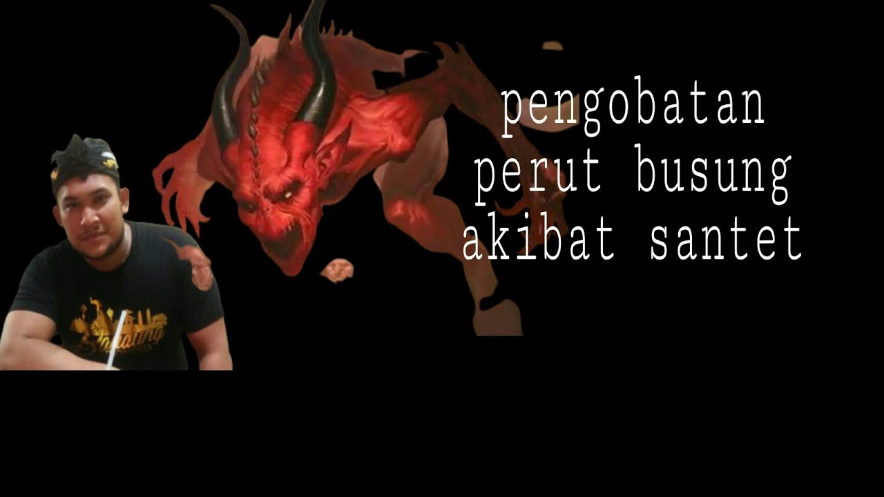Pengobatan perut busung akibat santet