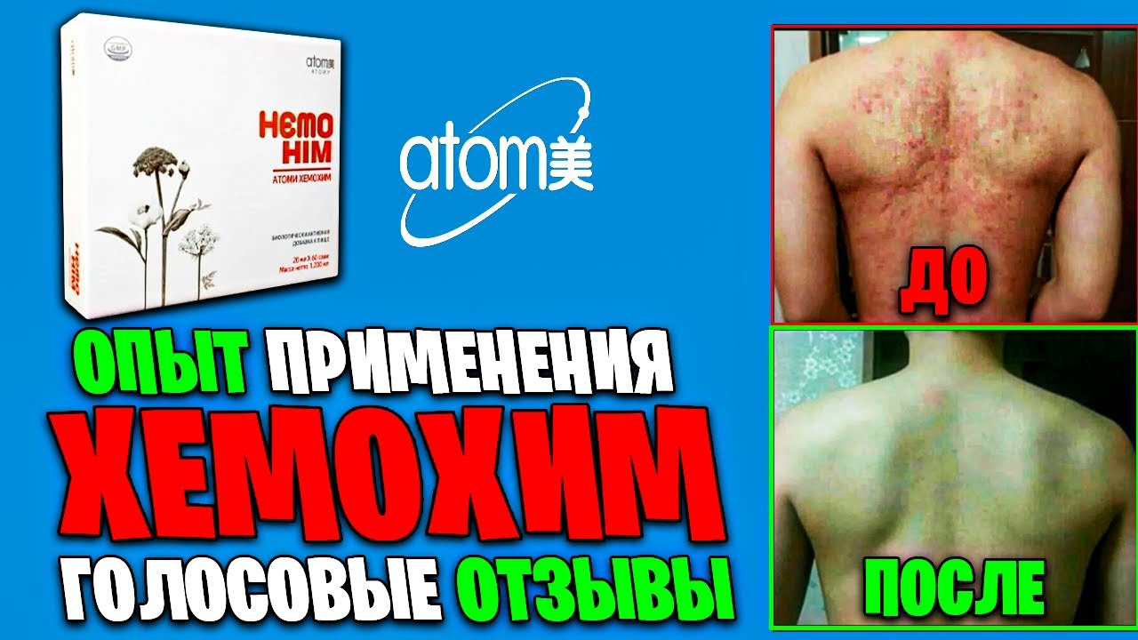 ✅ОТЗЫВЫ ЛЮДЕЙ ХЕМОХИМ | ЧЕСТНО про HemoHim #атоми #хемохим #atomy #hemohim  #здоровье #иммунитет