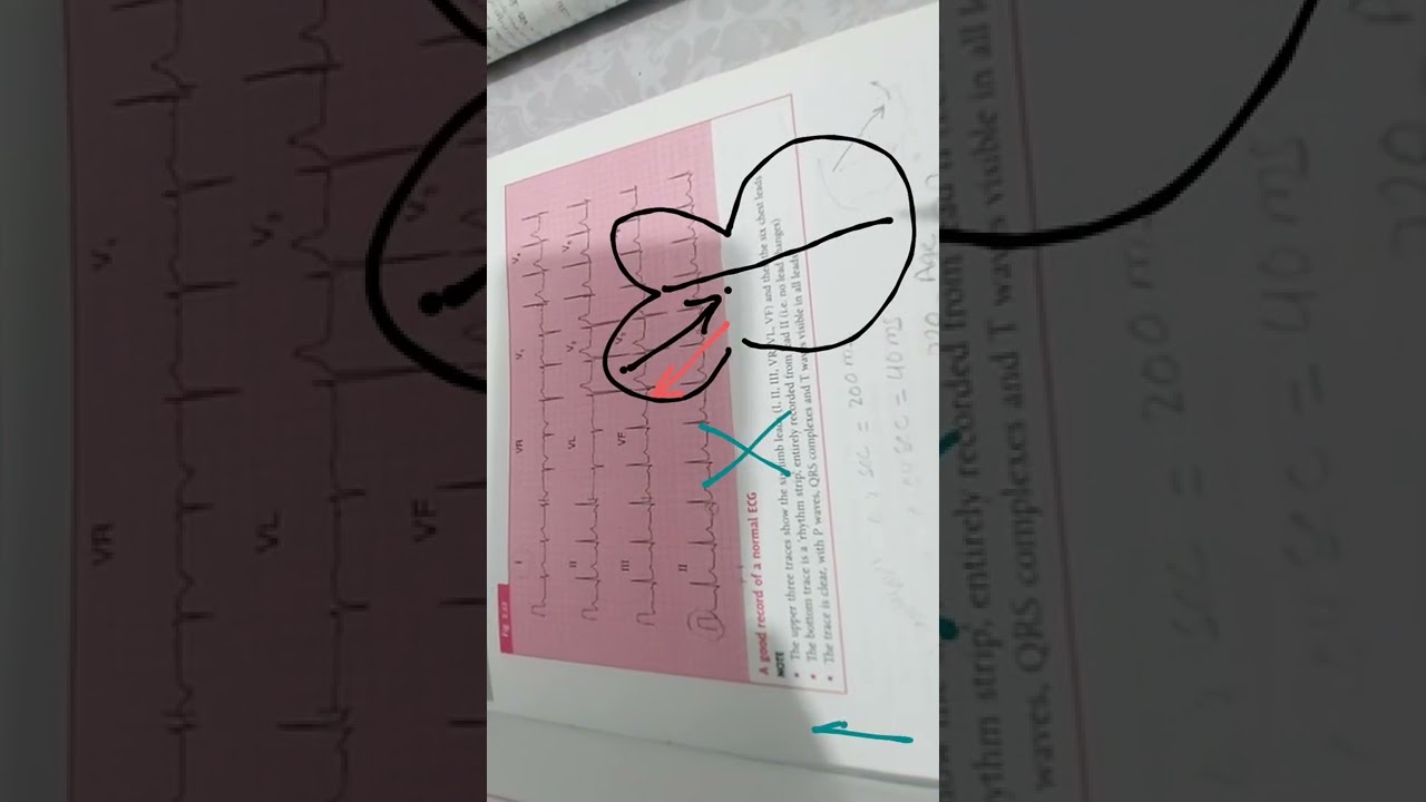 شرح ECG par 1