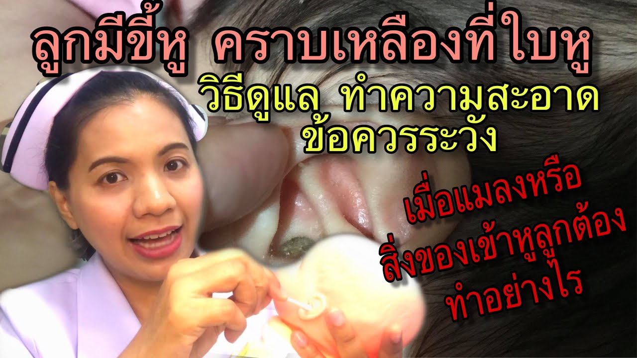 ลูกมีขี้หูมาก มีคราบไขมันที่ใบหู วิธีการดูแล ทำความสะอาดหู ข้อควรระวัง 