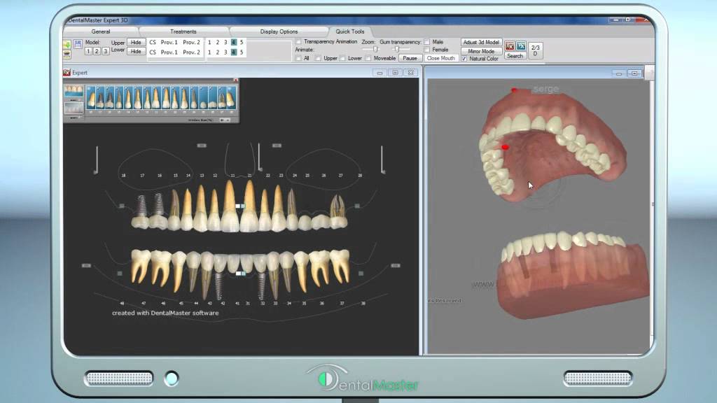 3D treatment planning , better than any ready made animation