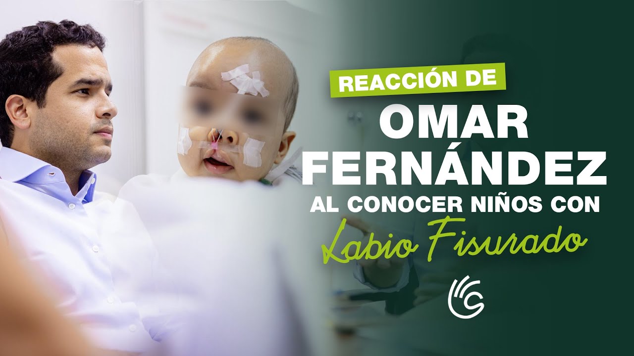 Omar Fernández Asume Causa De Niños Con Enfermedad De Labio Fisurado 🙏