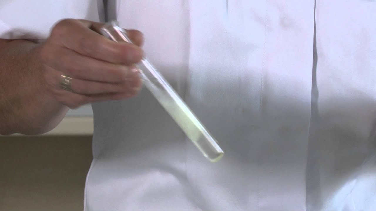 Az epe szerepe az emésztésben