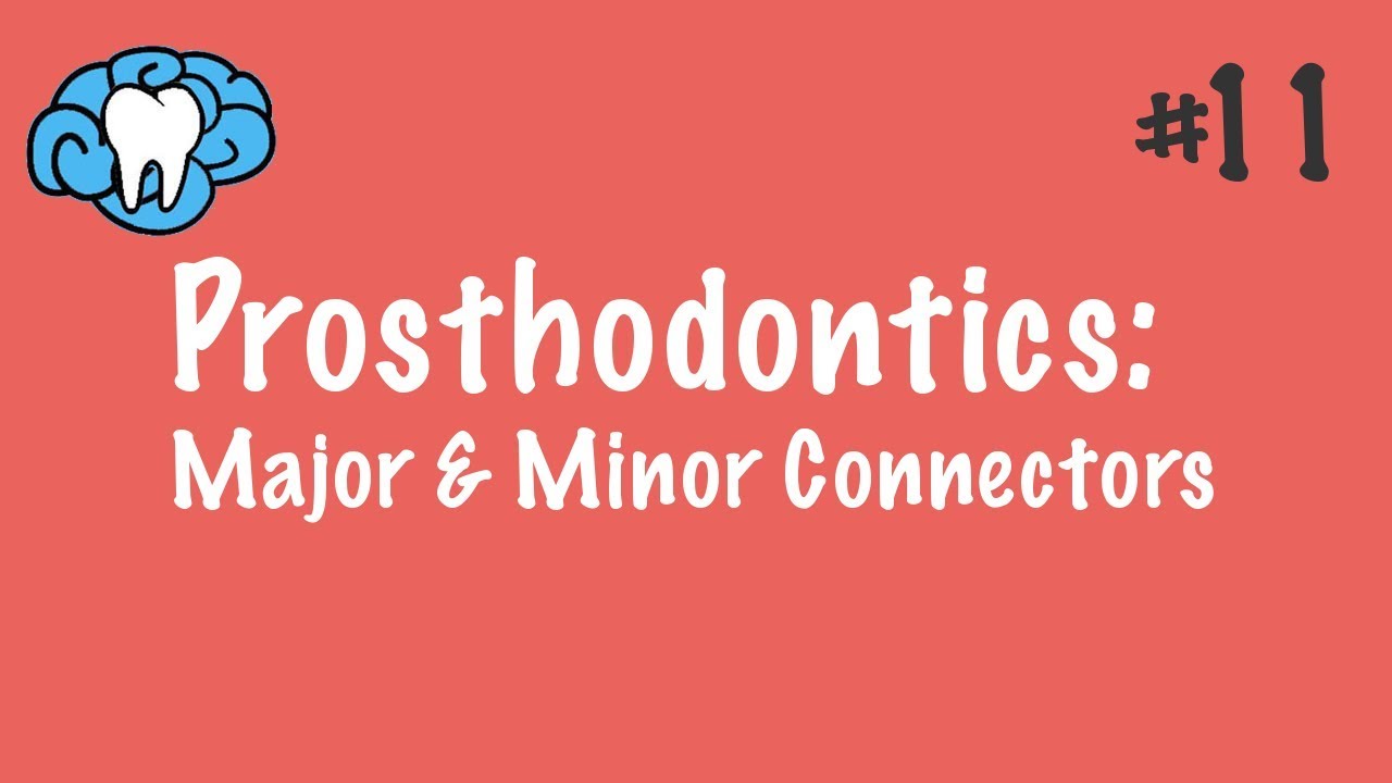 Prosthodontics | Major & Minor Connectors | INBDE, ADAT