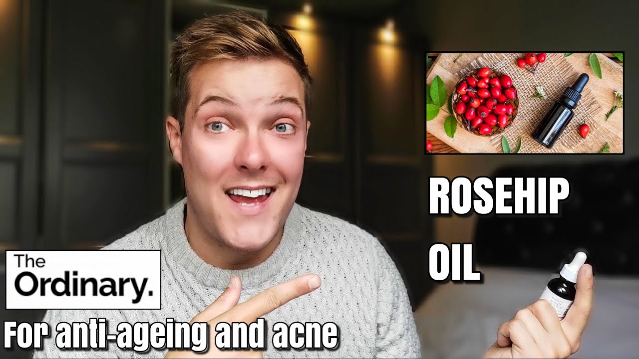 ROSEHIP OIL | 30 day test on oily skin - The Ordinary rosehip oil - rosehip oil before and after
