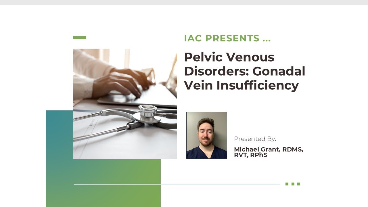 Pelvic Venous Disorders: Gonadal Vein Insufficiency