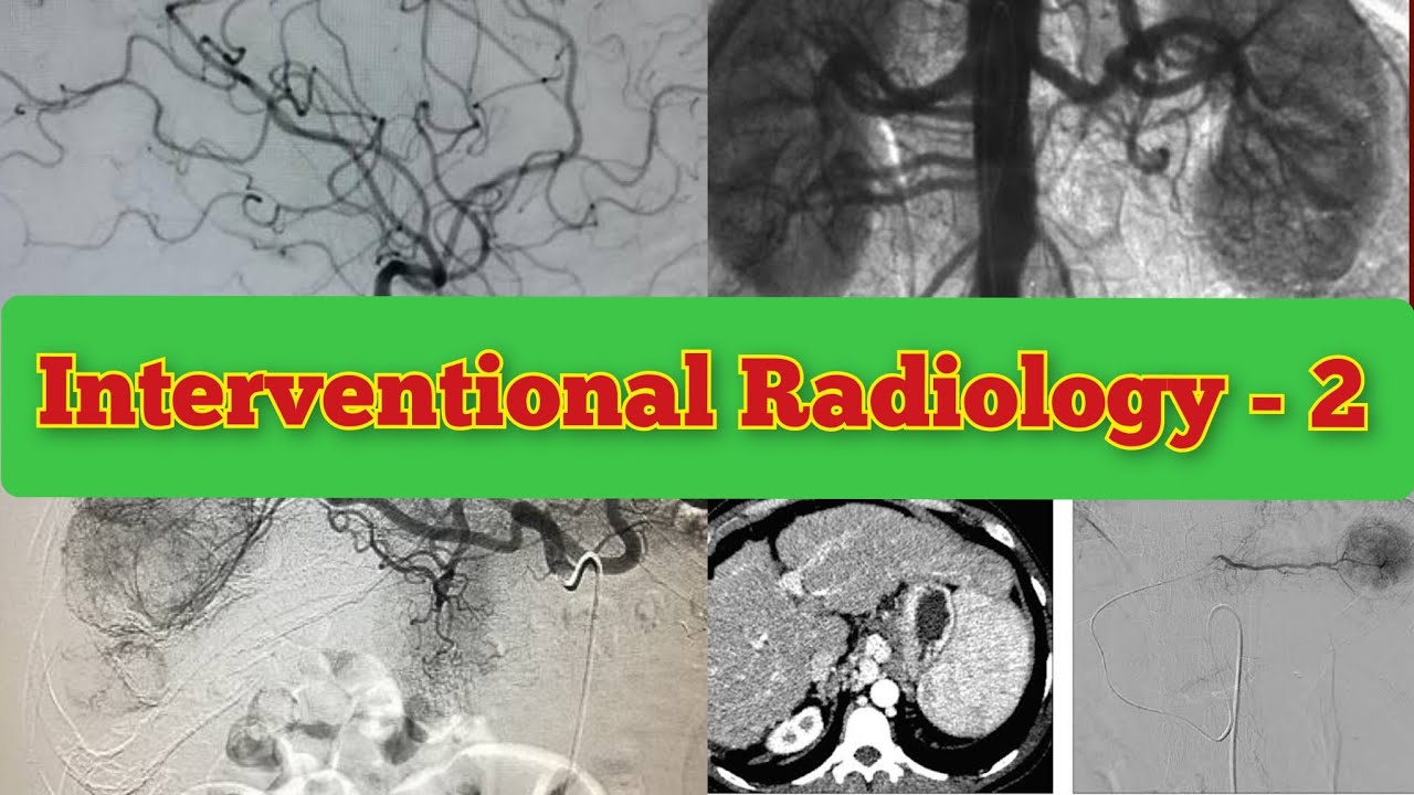 Radiology Viva Cases # 161-167 | Interventional Radiology Exam Cases #medical #radiology #ultrasound