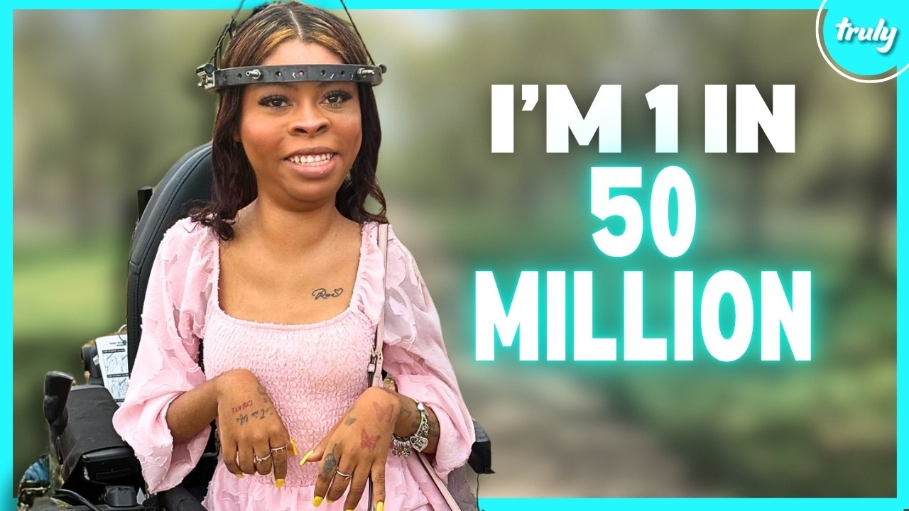 I Have 15 Screws In My Head To Straighten My Spine | BORN DIFFERENT