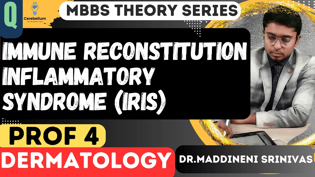 Immune reconstitution Inflammatory syndrome | Dermatology for 4th year MBBS |